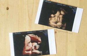 #1000hariperlindungan, sleek baby, golden moment, 1000 hari pertama kehidupan, kesehatan, kampanye #1000hariperlindungan