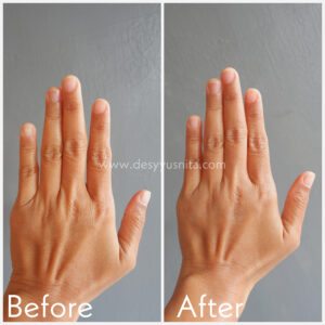 Sebelum dan Sesudah Pemakaian Scarlett Body Lotion