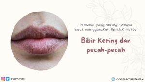 Bibir Kering Karena Lipstik Matte
